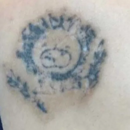 Disclaimer: This image was acquired online for information purposes , this is not a client of Rebel Inks Tattoos, Tattoo Removal and Body Piercings Parlor