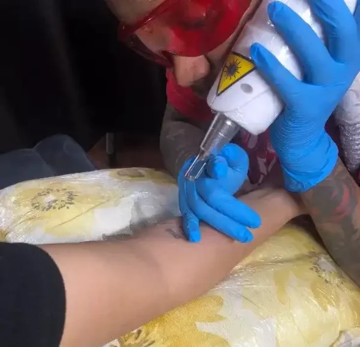 rebel-inks-tattoo-kenya-lead-artist-laser-tattoo-removal-session