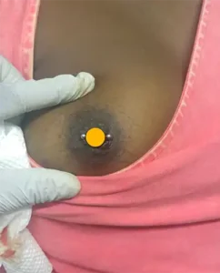 nipple-piercing