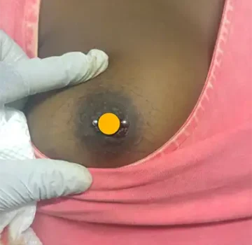 nipple-piercing