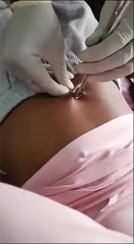 navel-piercing-procedure
