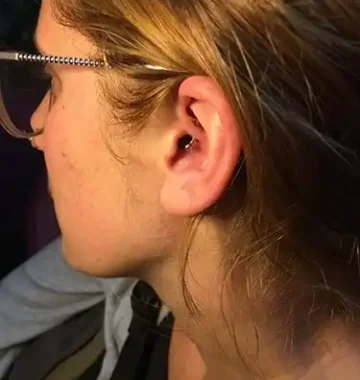 daith-piercing