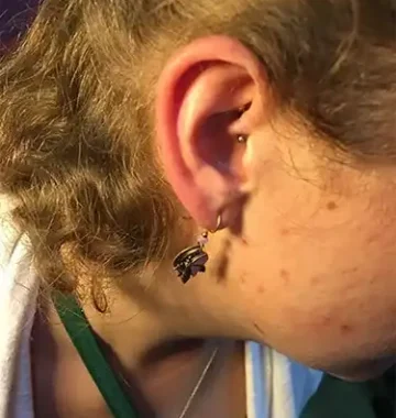 daith-piercing