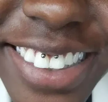 smiley-piercing