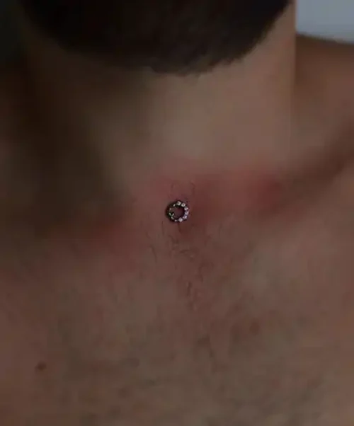 dermal-piercing