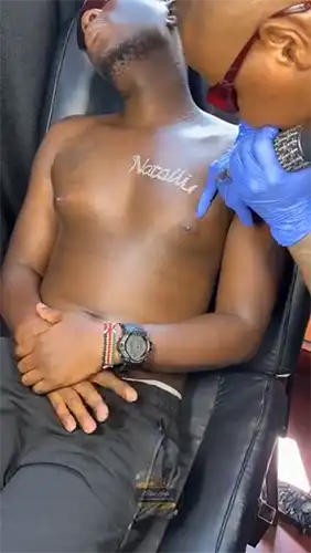 laser-tattoo-removal-of-a-chest-name-tattoo