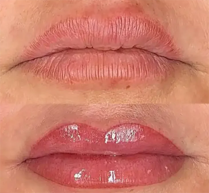 lip-blushing-in-nairobi-kenya