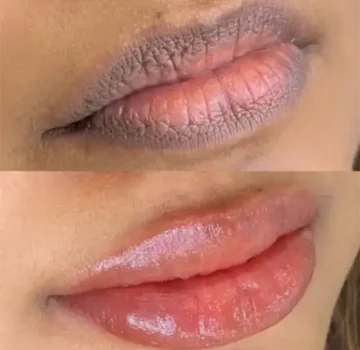 lip-blushing-in-nairobi-kenya