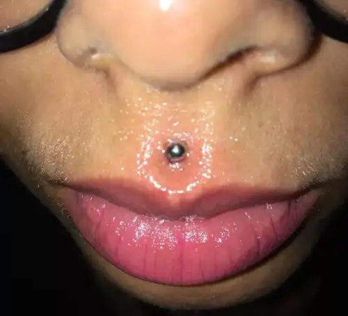 Medusa Piercing medusa-piercing-procedure