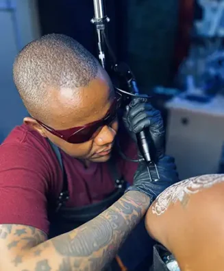 Laser Tattoo Removal