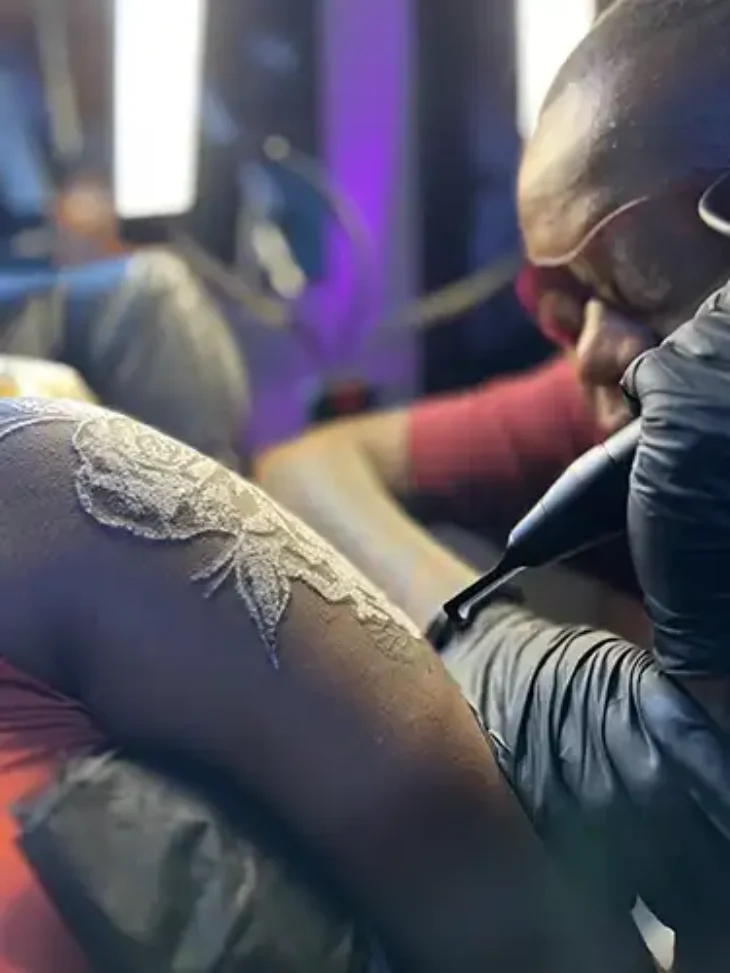 picosure-laser-tattoo-removal